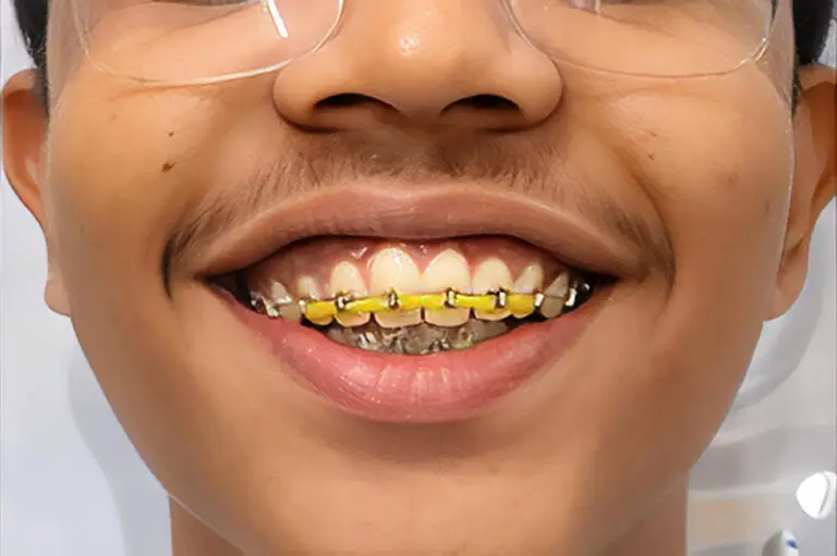 Best Dentist and Dental Clinic for Orthodontic Brace Treatment