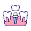 Best Tooth or Dental Implant Service in Kolkata