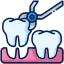 Best Teeth Extraction Painlessly in Kolkata