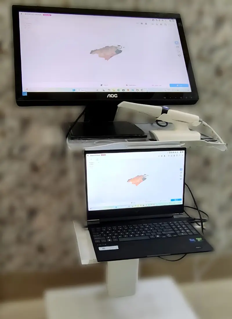 Intraoral 3D Scanner